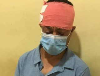 राससका बरिष्ठ समाचारदाता राजाराम कार्कीमाथि आक्रमण, आक्रमणकारीलाई कारबाही गर्न माग